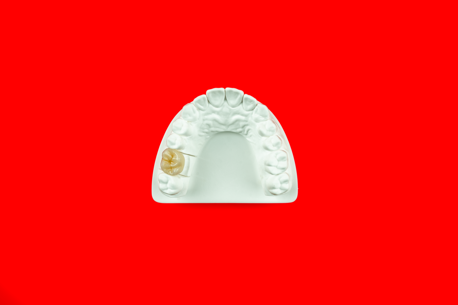 Couronne full zirconium